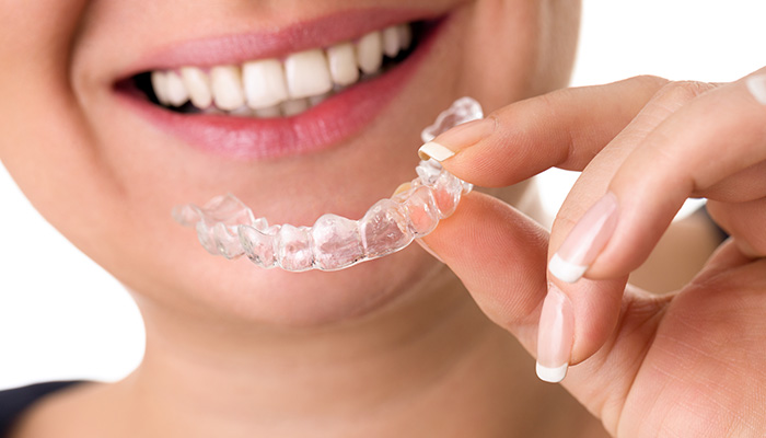 Invisalign Surrey